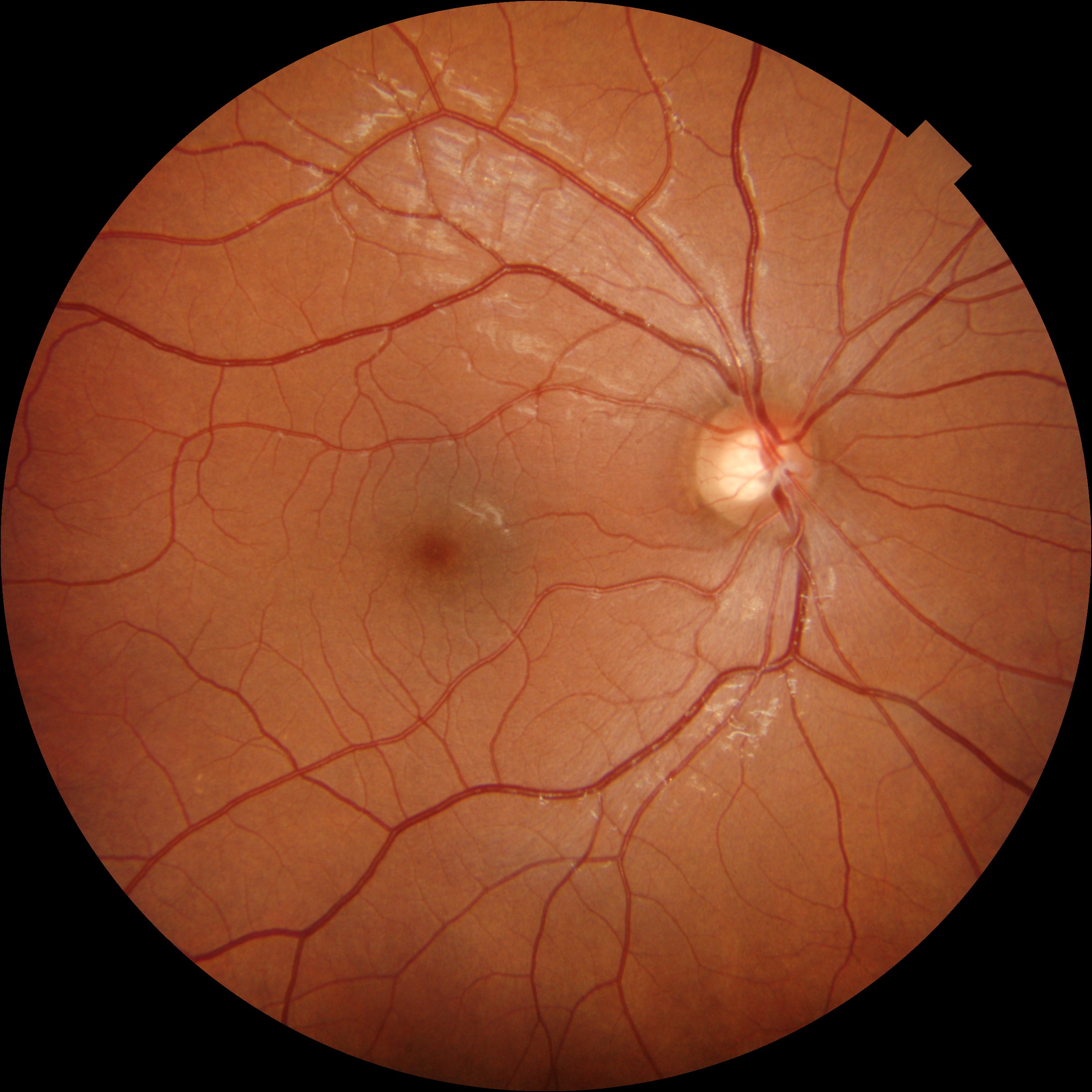 Fundus annotation canvas
